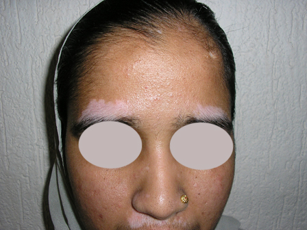 Dr Pandya Clinic Udaipur